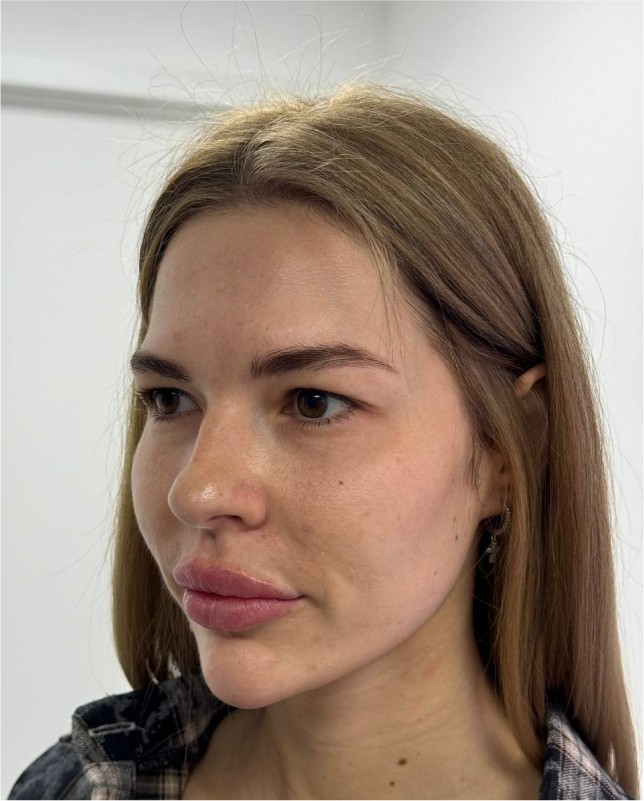 face
