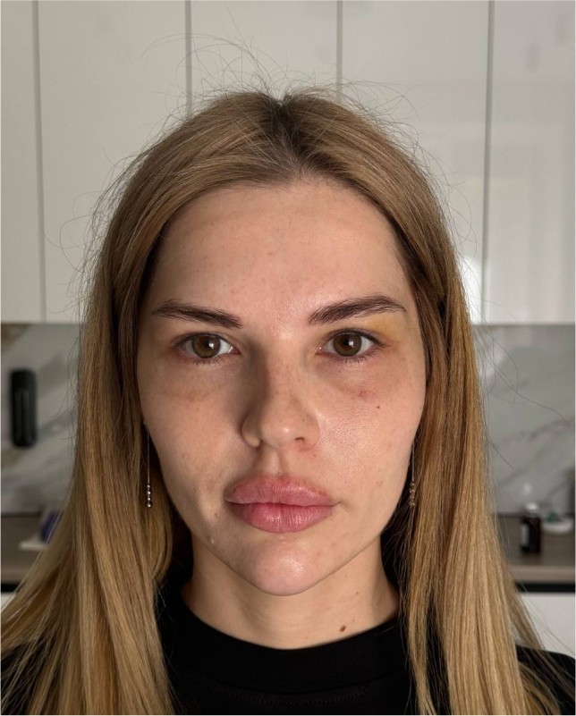 face