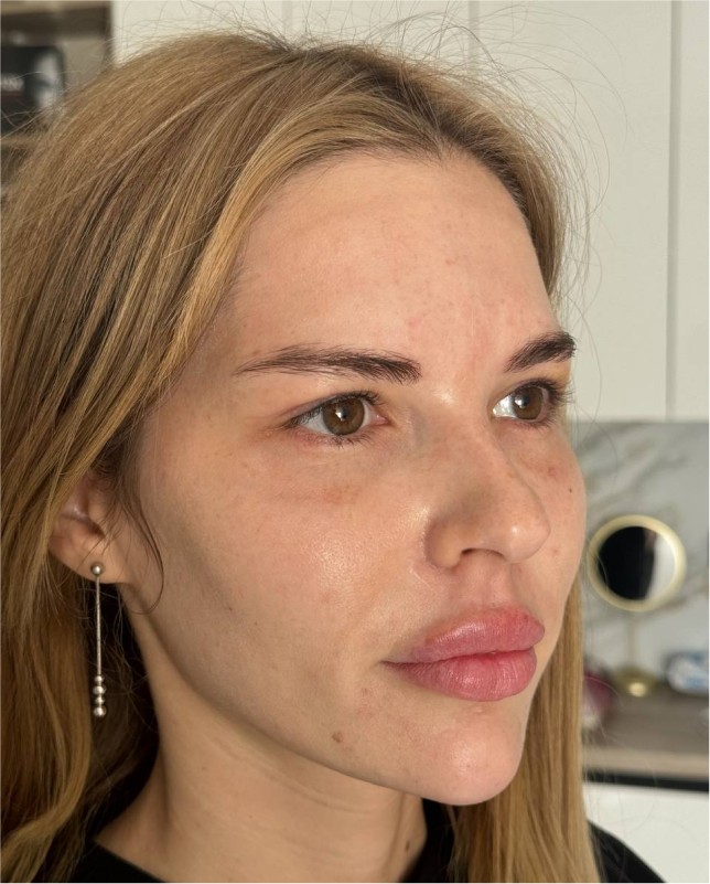 face