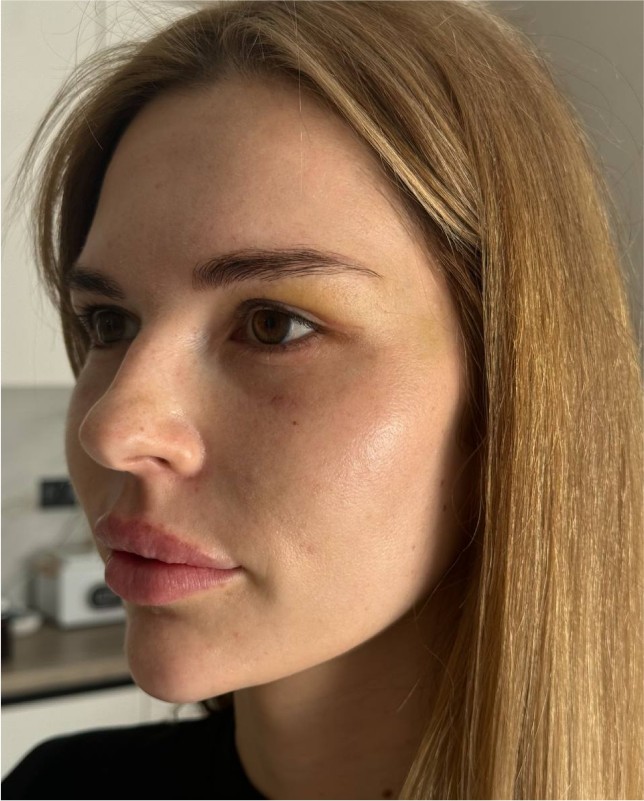 face
