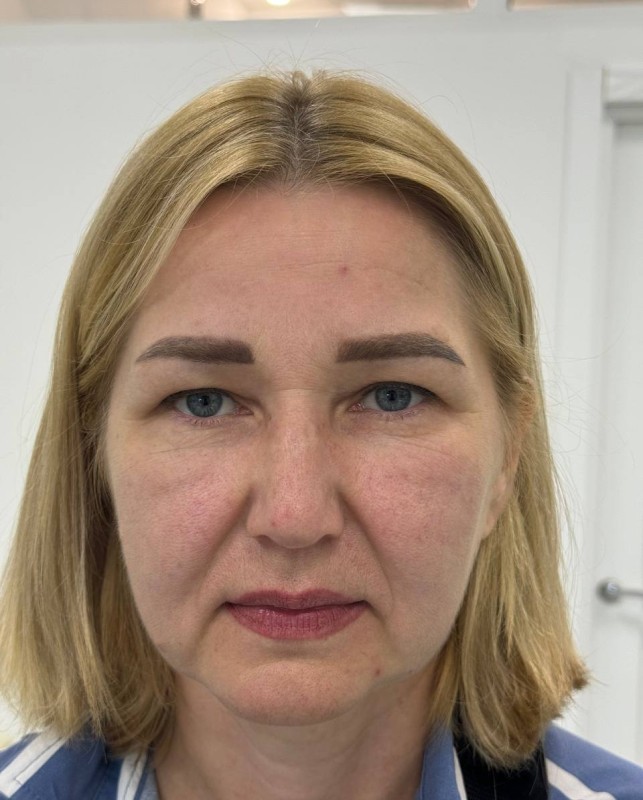 face