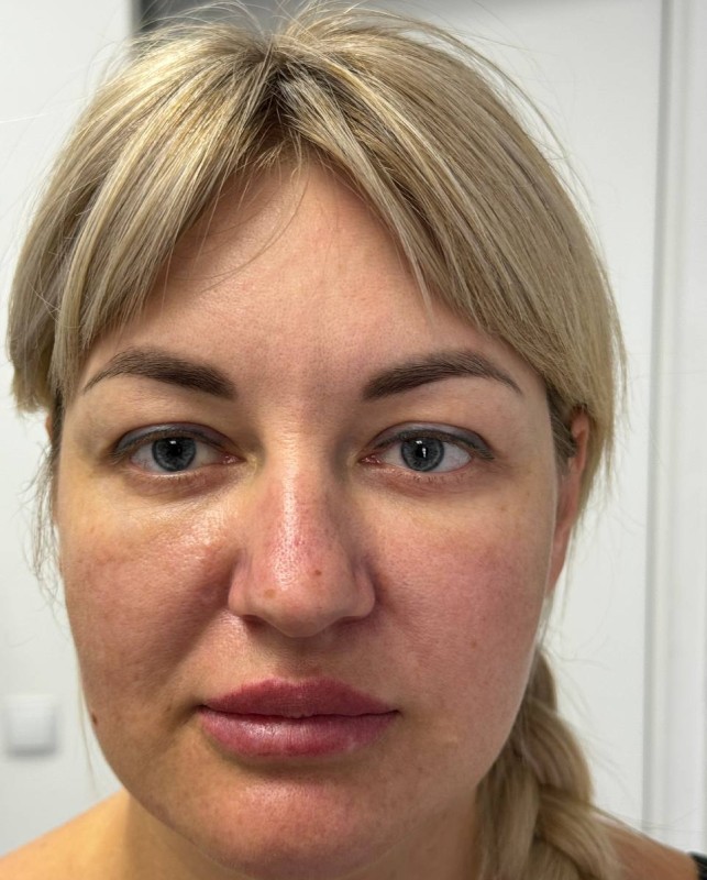 face