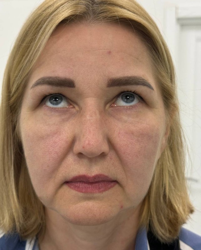 face