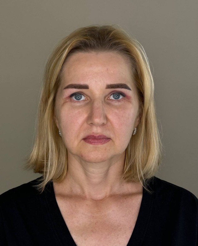 face
